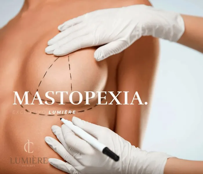 Mastopexia